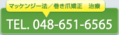 マッケンジー法／巻き爪矯正
048-651-6565